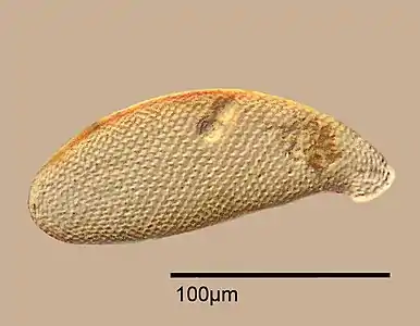 Shell of Cyphoderia ampulla, composed of circular, siliceous plates produced by the amoeba